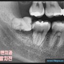 서울프리벤치과의원 이미지