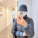 NO.1 자동차피부과 | 신사동피부과 리쥬란후기 리쥬란아이 1cc 일주일차 효과
