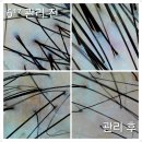 제주토탈홈케어 | 공덕두피관리 스킨핏헤드스파 마포공덕점에서 여름맞이 헤드스파로 힐링