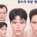 서정리가발