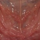 전북치과기공소 이미지