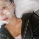 제이디의원 | 신논현피부과 덴서티하이 200샷 리프팅 + 엑소원 스킨부스터 후기, 통증, 효과