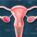 에이스남성의원 이미지