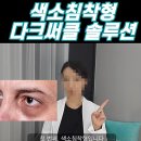 올리브약국 | 다크서클 없애는법 총정리 :: 시술/약국/올리브영