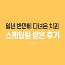 반치과 | 화명동 치과 일 년 반 만에 스케일링 받은 후기 결과는?