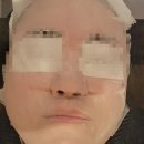 파인웨이브 | 마곡 파인웨이브 마곡 피부과에서 페이스 리프팅 받은 후기
