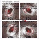 별해별 감자탕 | [임신기록] 장꾸맘 각도법 정확도, 태아성별 맞추기 +장꾸맘 별해별 감자탕 후기❤️