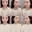 갈매역 | 약손명가 구리갈매역점 찐 후기, 신부관리/피부관리/에그셀런트관리(전후사진O)