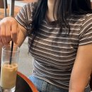 청산약국 | 안양평촌 복부 지방추출주사 대만족 후기(당일~4일차/통증/붓기/부작용/멍) 다이어트 병원 추천