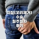 쾌항외과의원 | 치질 꼬리제거 수술 일주일치 후기