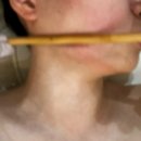 봉명동피부관리 더예쁜날 대전유성점 뱀부테라피 후기