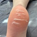 대구 북구 대현로19길 53 | 대구발각질 제거 패디플래닝 맛집 안나뷰티 솔직후기