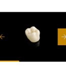 오스비스 이미지