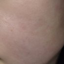 빽다방부평테마의 | 부평 피부관리 데자뷰메디스킨 속건조 잡는 수분초음파로 물광 피부 변신 후기