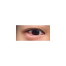 아인스안과 네이버블로그