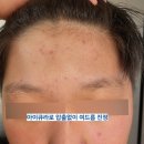 바르델
