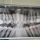 덴탈 케어 시스템 이미지
