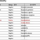 스트렙토코커스, 코리네박테륨, 칸디다 알비칸스는 어떤 항생제가 잘 듣나요? 이미지