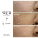 공업탑피부관리