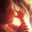 Foetus/Fetus/태아; 4월 4일 금요일 이미지
