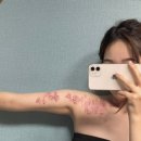 이석종피부과의원 네이버블로그