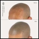 탈모왕 본점 이미지