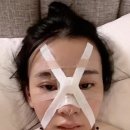 한국에서 성형 및 시술받고 새로 태어난 중국인 이미지
