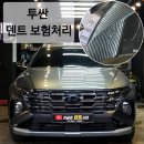 지금은덴트시대
