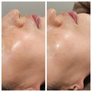 B&B에스테틱 네이버블로그
