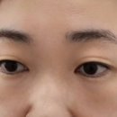 스칼프랩앤뷰티 속눈썹&눈썹&탈모 의정부점 이미지