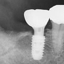 연세내일치과의원 이미지