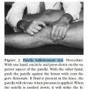 Differential Diagnosis of a Patient Presenting With a Knee Effusion 이미지