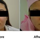 전안과의원 이미지