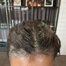 해바라기 헤어라인 | [고양 일산] 운정미용실 덕이동미용실 아이디헤어 덕이점 다해 부원장 손상적은 비건염색후기