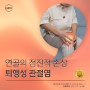 의료법인벽암의료재단 큰바다요양병원 | 창원 요양병원 퇴행성 관절염 수술이 필수일까? 비수술 치료와 관리 방법