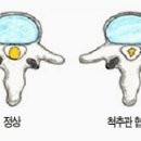 척척디즈크한의원 이미지