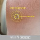 동안약국 | 강동구청역 발굳은살 약국 티눈 밴드 대신 케어 후기