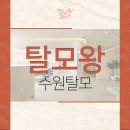 탈모왕수원