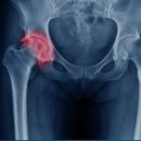 신흥동001 이미지