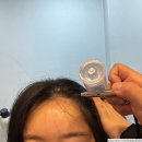 산본 탈모 · 산본 두피 관리, 닥터모락 맞춤 두피관리 후기! 두피 진단부터 데톡스 케어까지