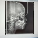 연세예쁜미소치과의원 이미지