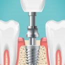 최정원치과의원 이미지