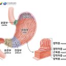 위암 이미지