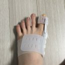 주식회사 엄지 | [제품리뷰] 발가락교정기 케어풋 무지외반증교정기 일주일 착용 후기