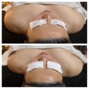짱언니 | 향남 피부관리 짱언니뷰티살롱 후기｜상체 붓기·부유방 관리 효과 솔직변화