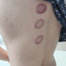 지로한의원 이미지