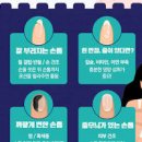 손톱 검은 세로줄 원인 예방 내 몸이 보내는 적신호일까? 이미지