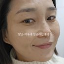 황금손49