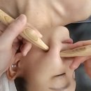 휴스킨 네이버블로그