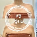뉴아이뱅크 안경 | 부평역 승모근 관리 잘하는 엘리뉴 에너지 테라피 솔직후기